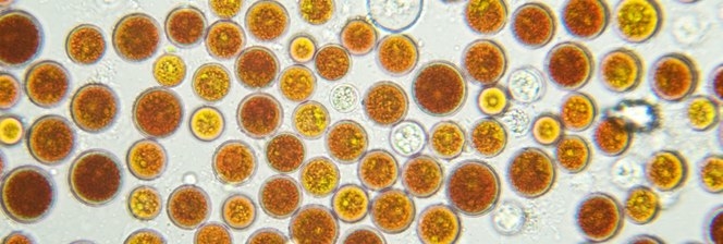 Image de présentation Désintégration de cellules efficace avec les broyeurs à billes DYNO®-MILL 